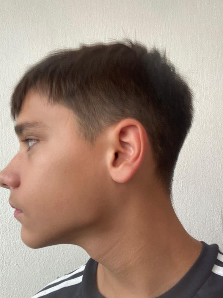 1000003024