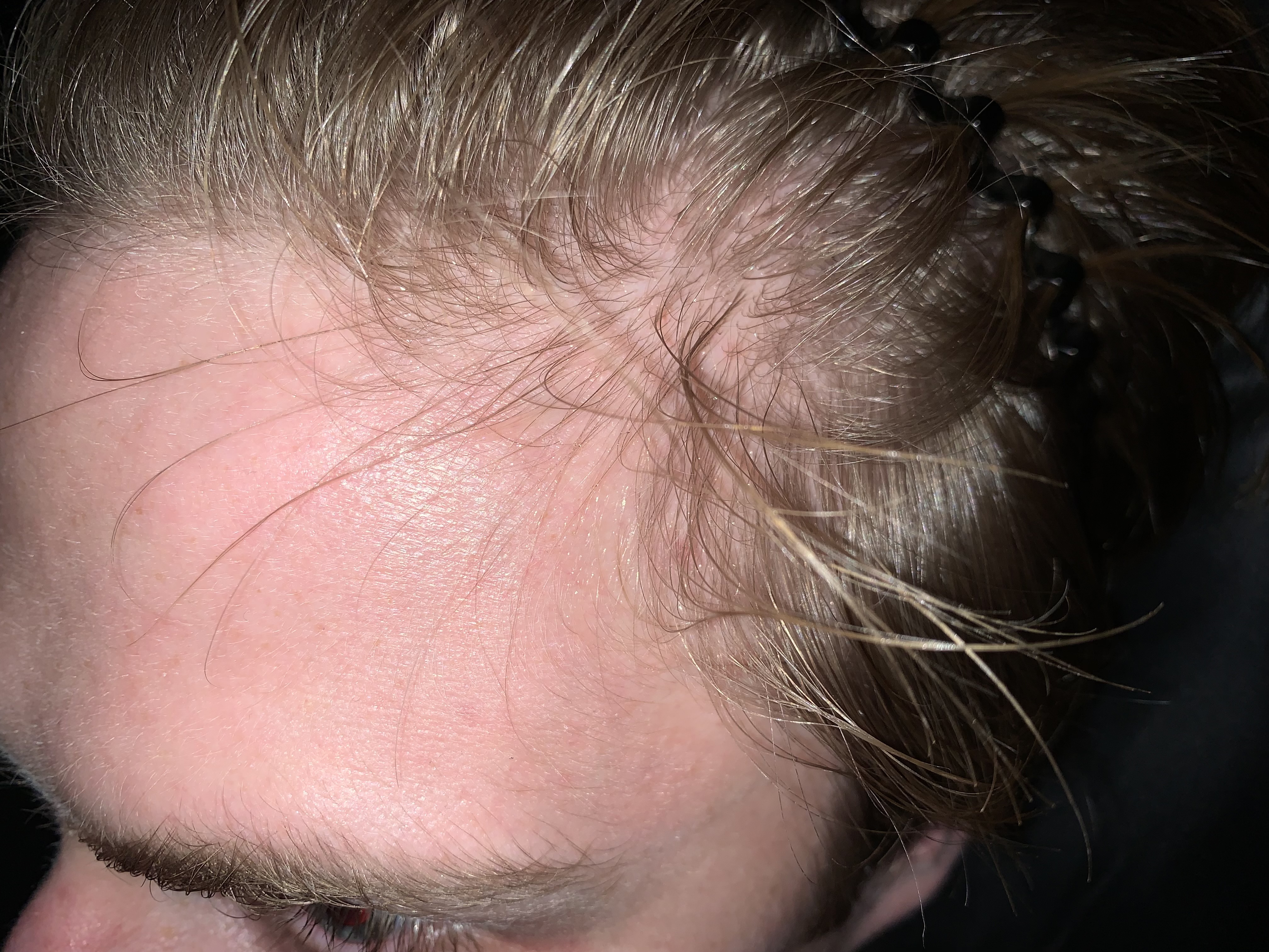 IMG 0399
