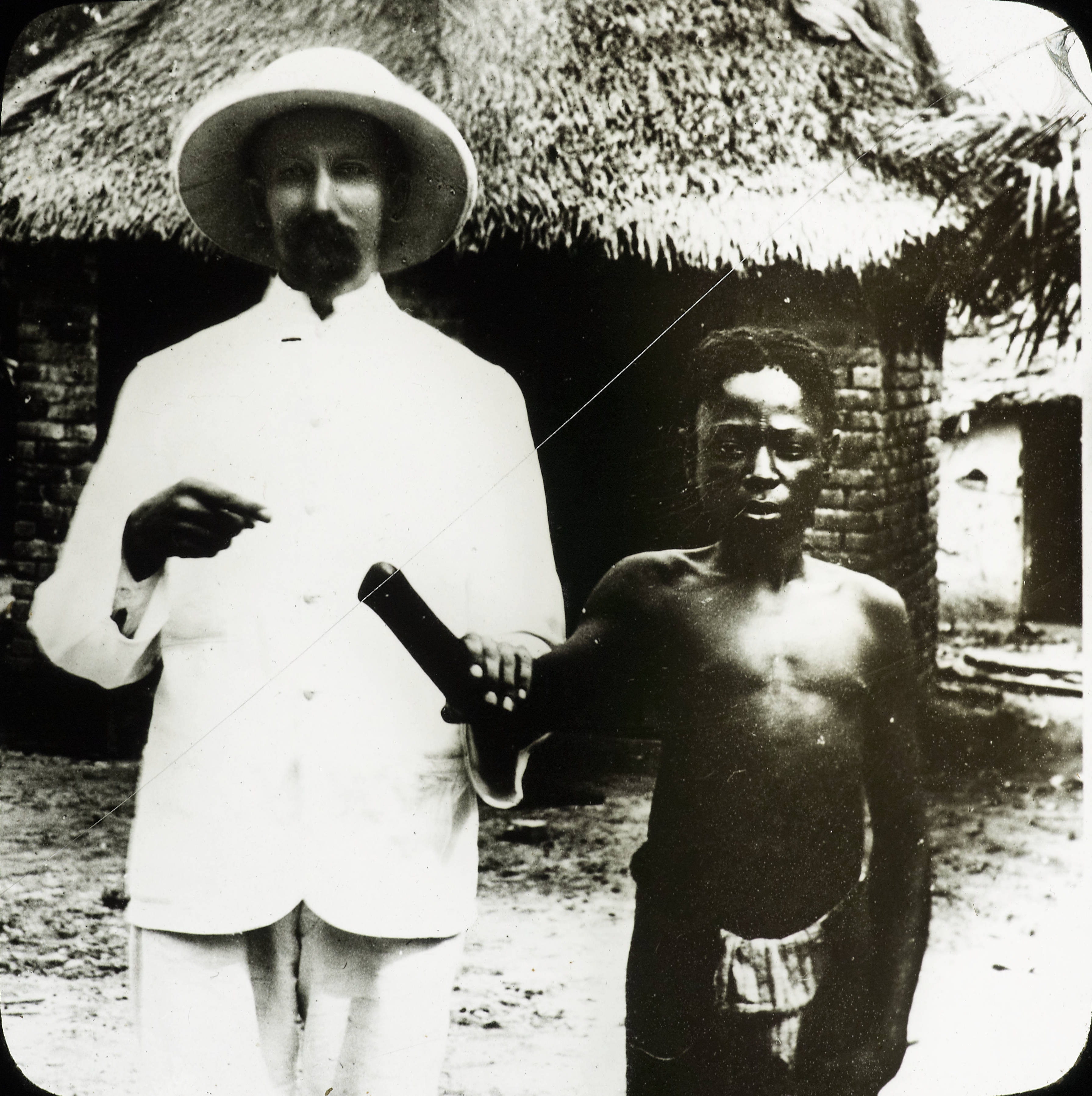 Victim of Congo atrocities Congo ca 1890 1910 IMP CSCNWW33 OS10 19