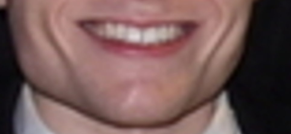 Smile