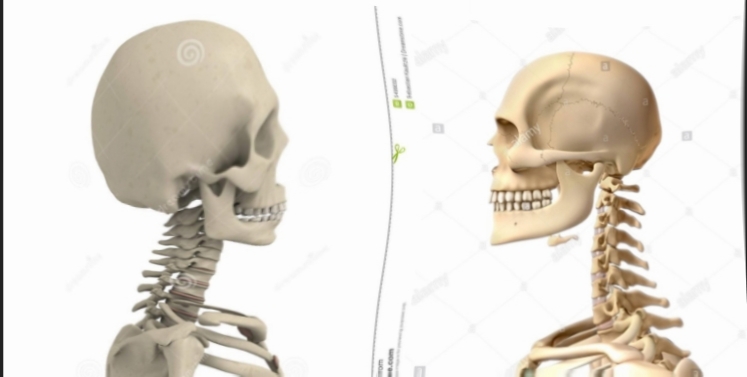 1000025012