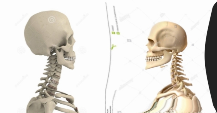 1000025014