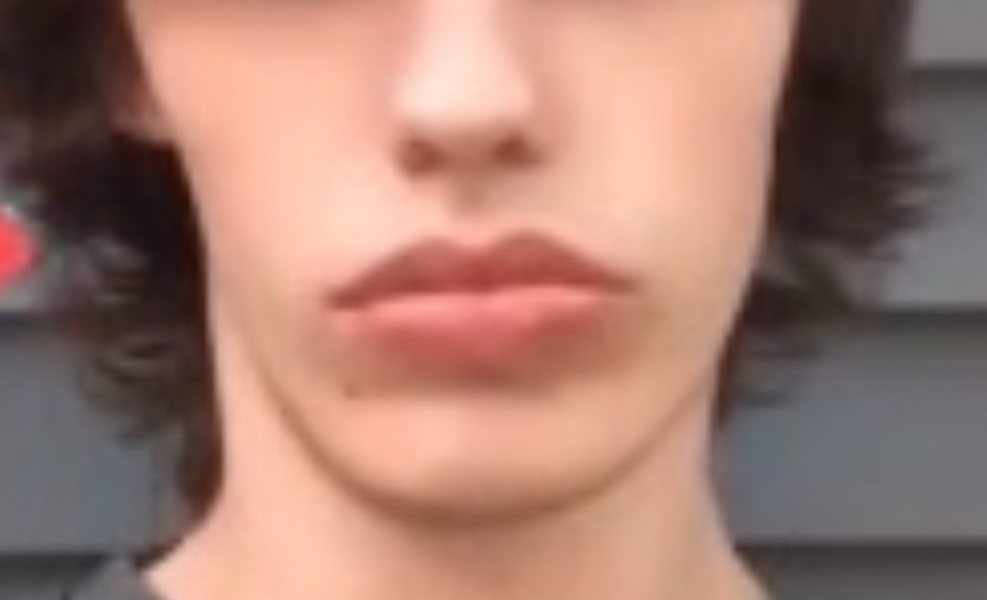 BadJaw