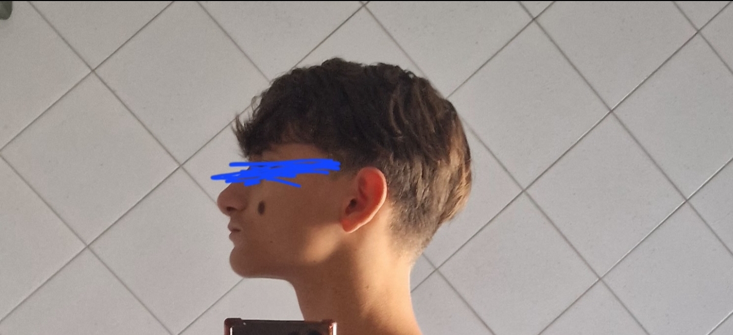 1000149154
