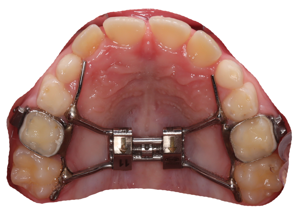 Expander 1024x732