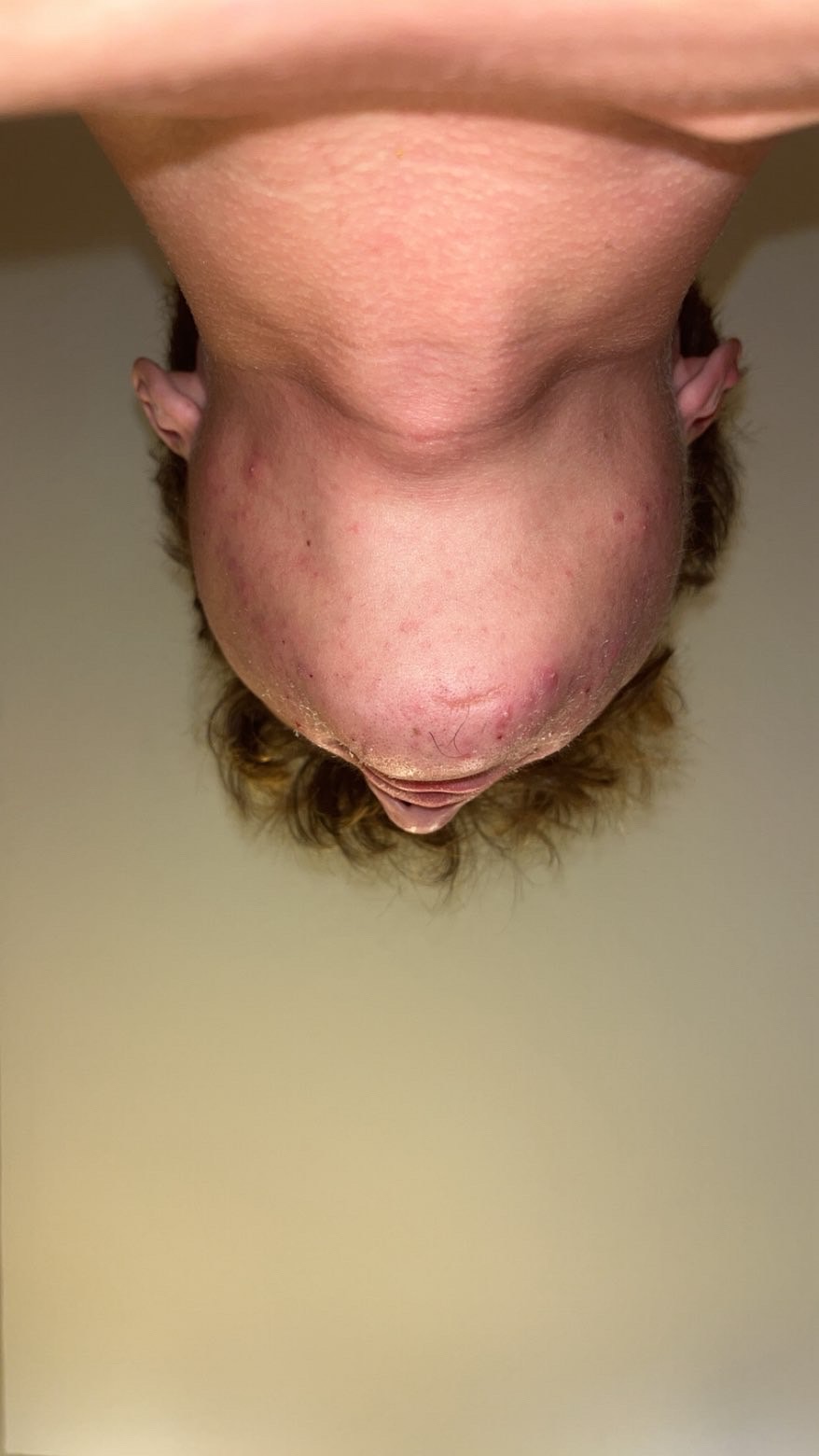 IMG 2807