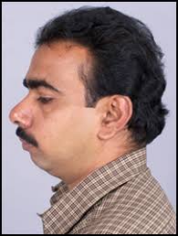 COSMETIC SURGEON INDIA