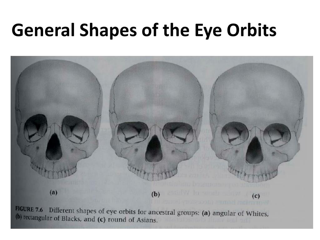 General shapes of the eye orbits l