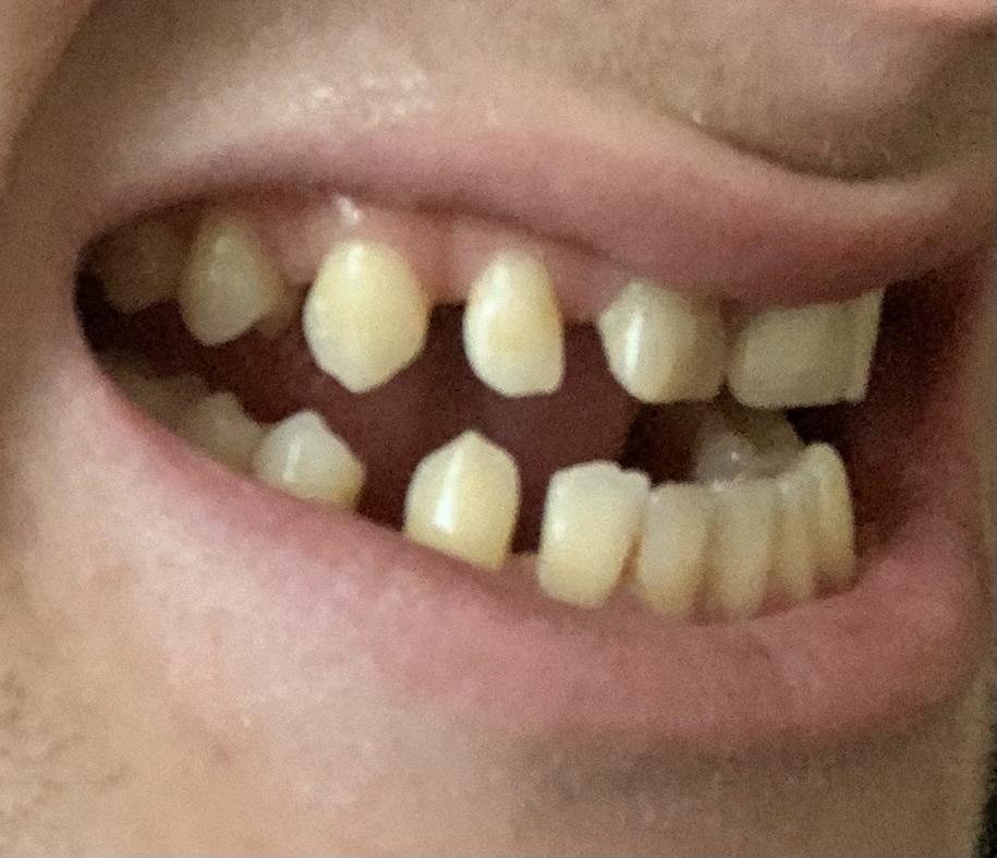 IMG 0961