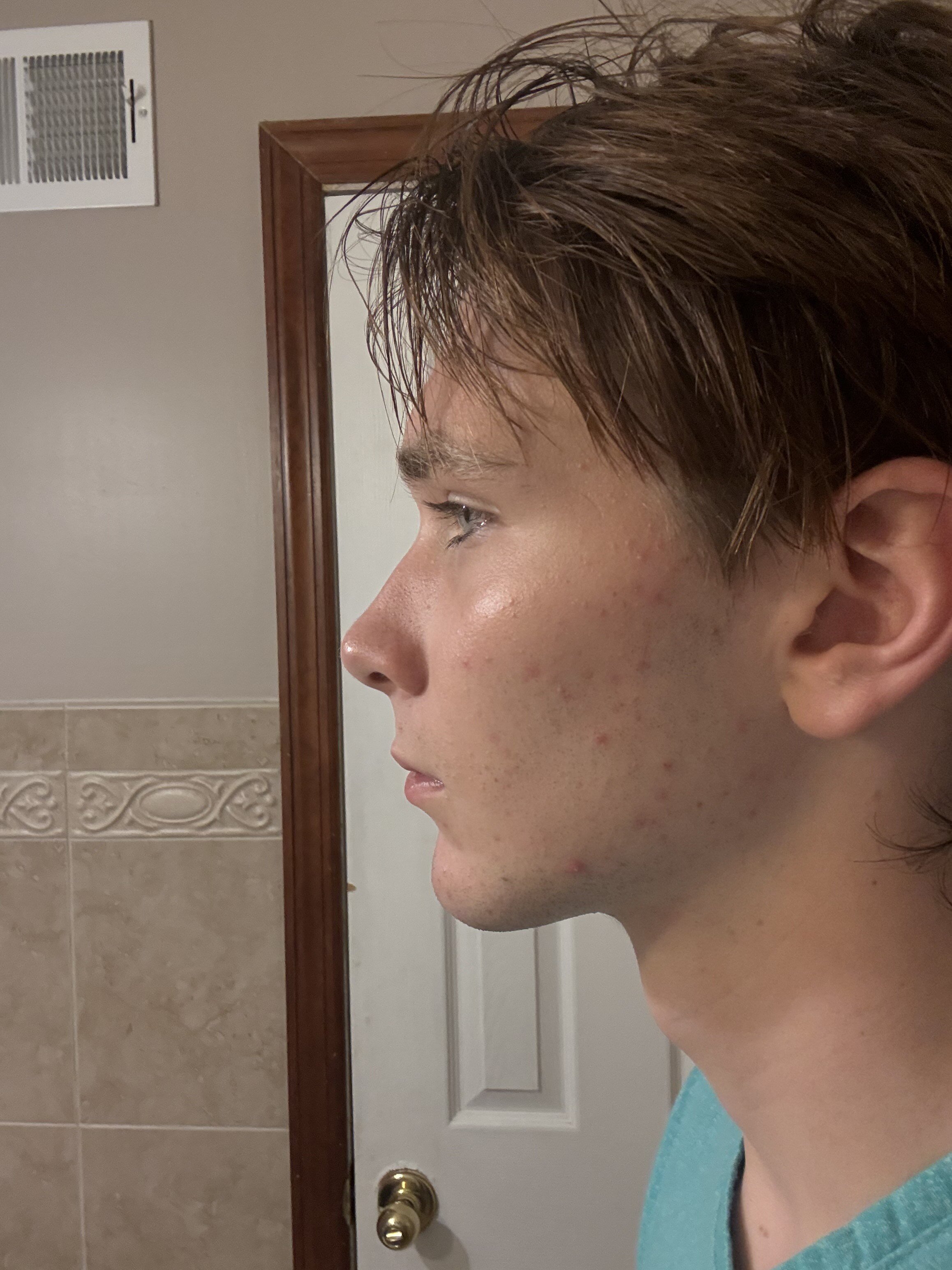 IMG 0568
