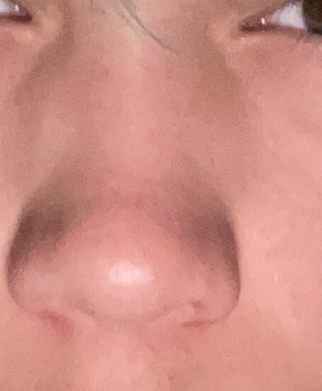 Oser