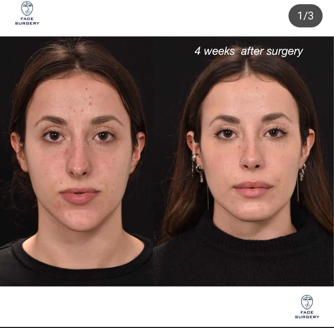 Screenshot 20250923 194639 Instagram