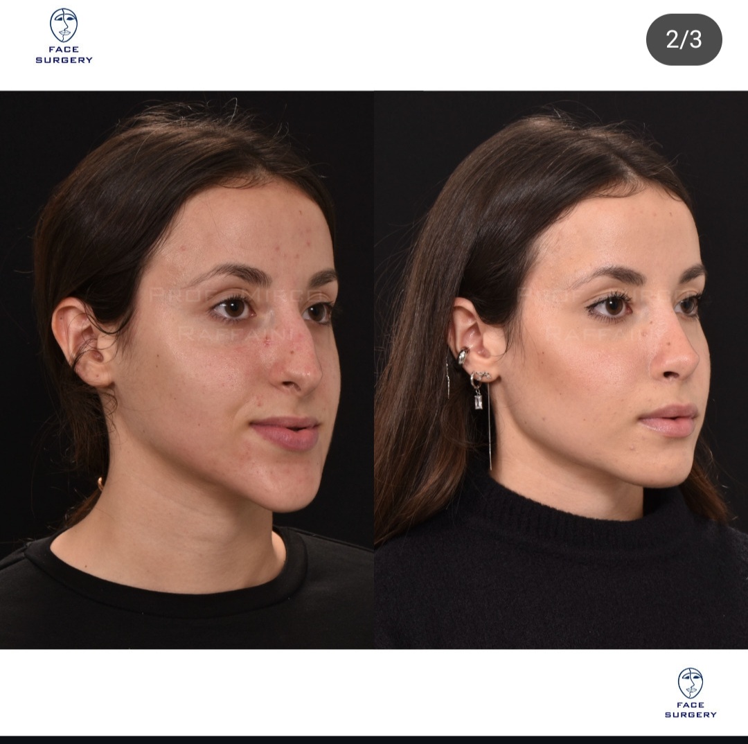 Screenshot 20250923 194647 Instagram