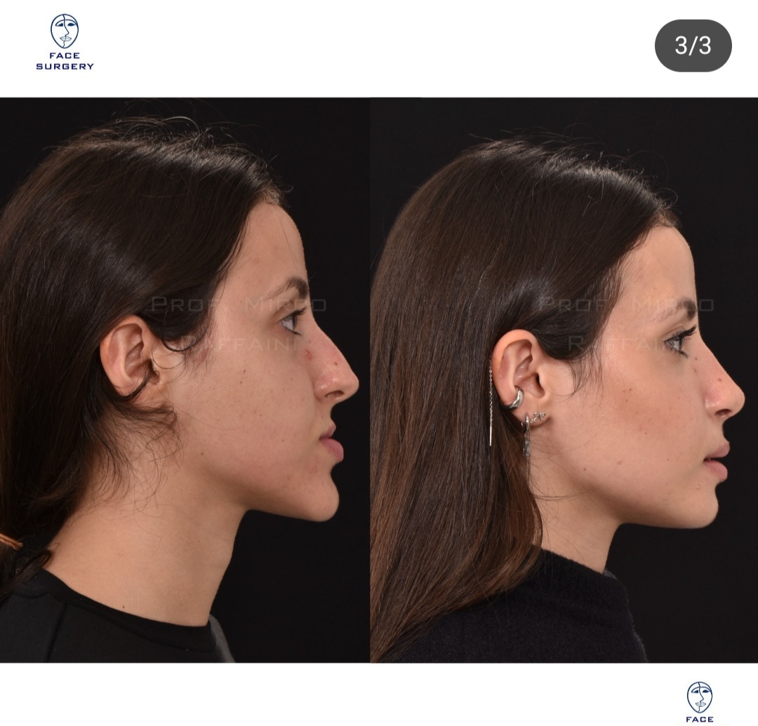 Screenshot 20250923 194654 Instagram