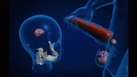 ZyPb5L