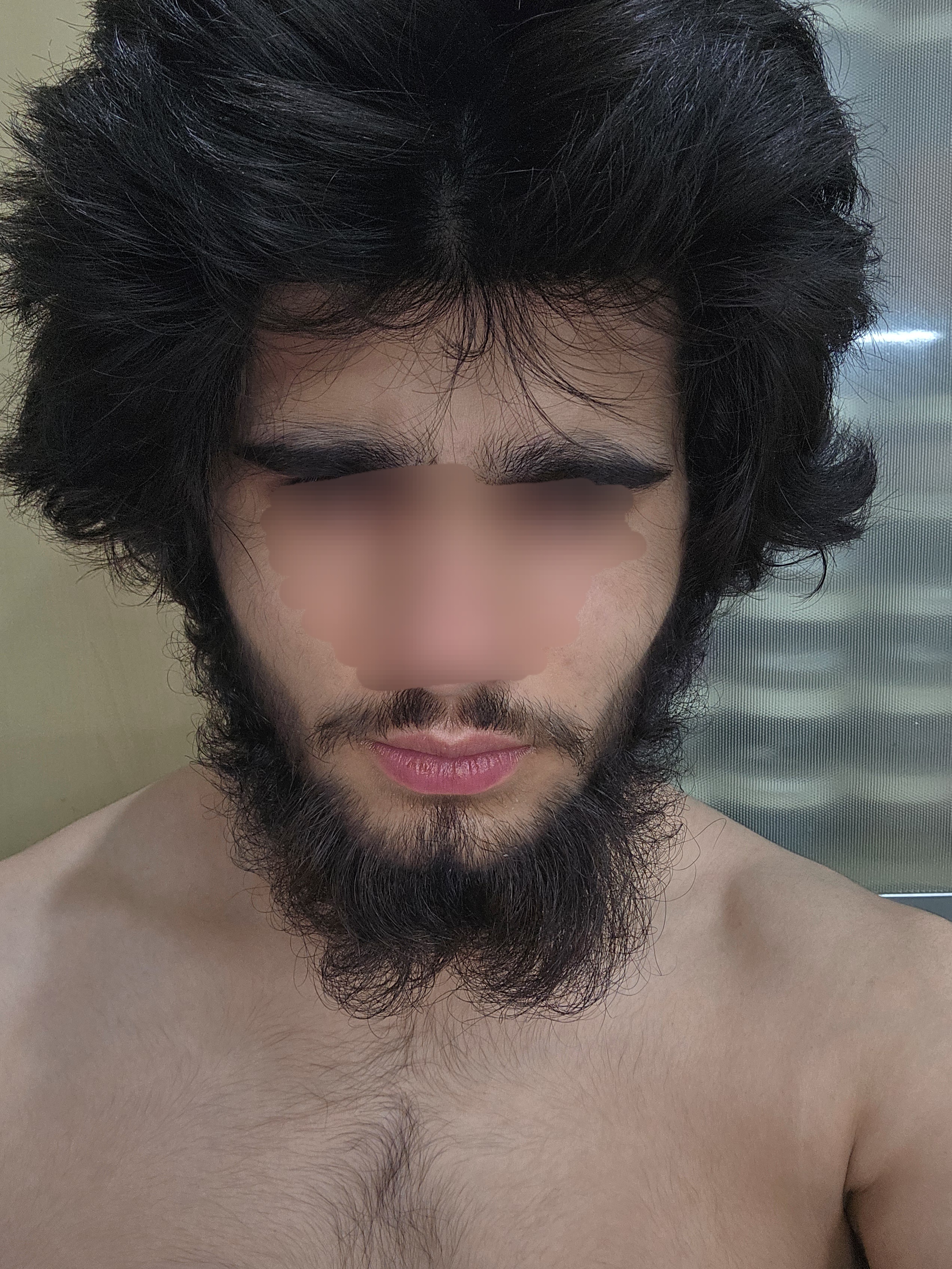 20250612 0218281