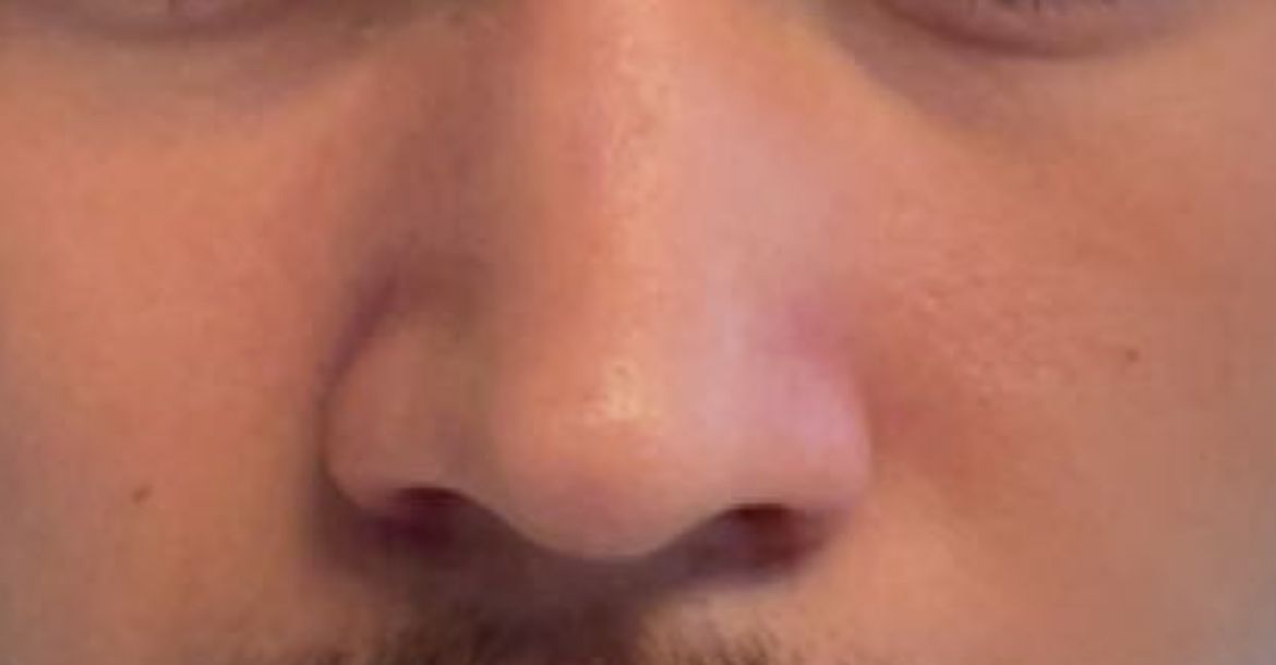 IMG 0395