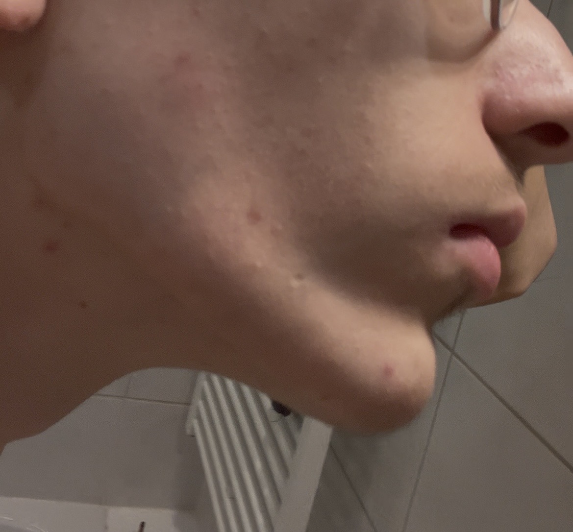 IMG 2302