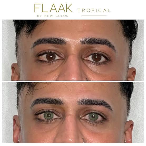 1000025423 1000025423