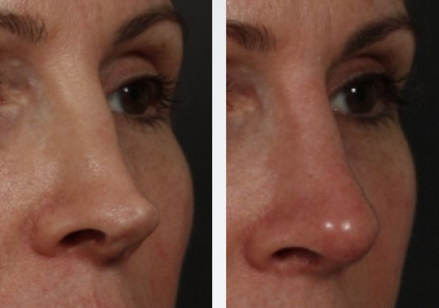 0e434cb12a9c87d93fcf21593dfce344