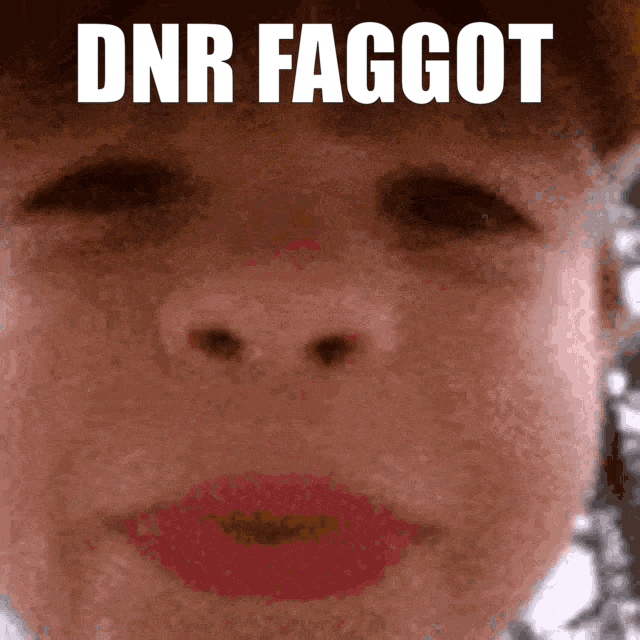 Spit1