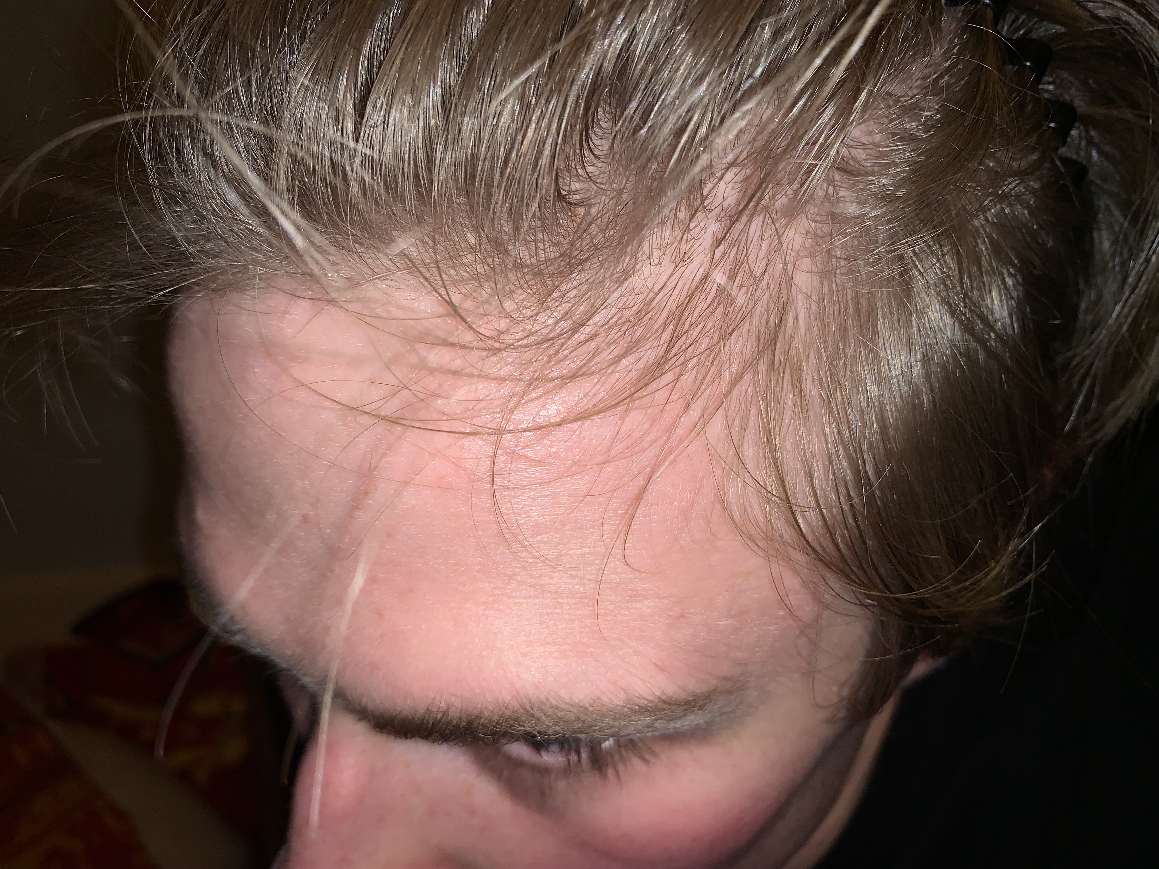 IMG 1186
