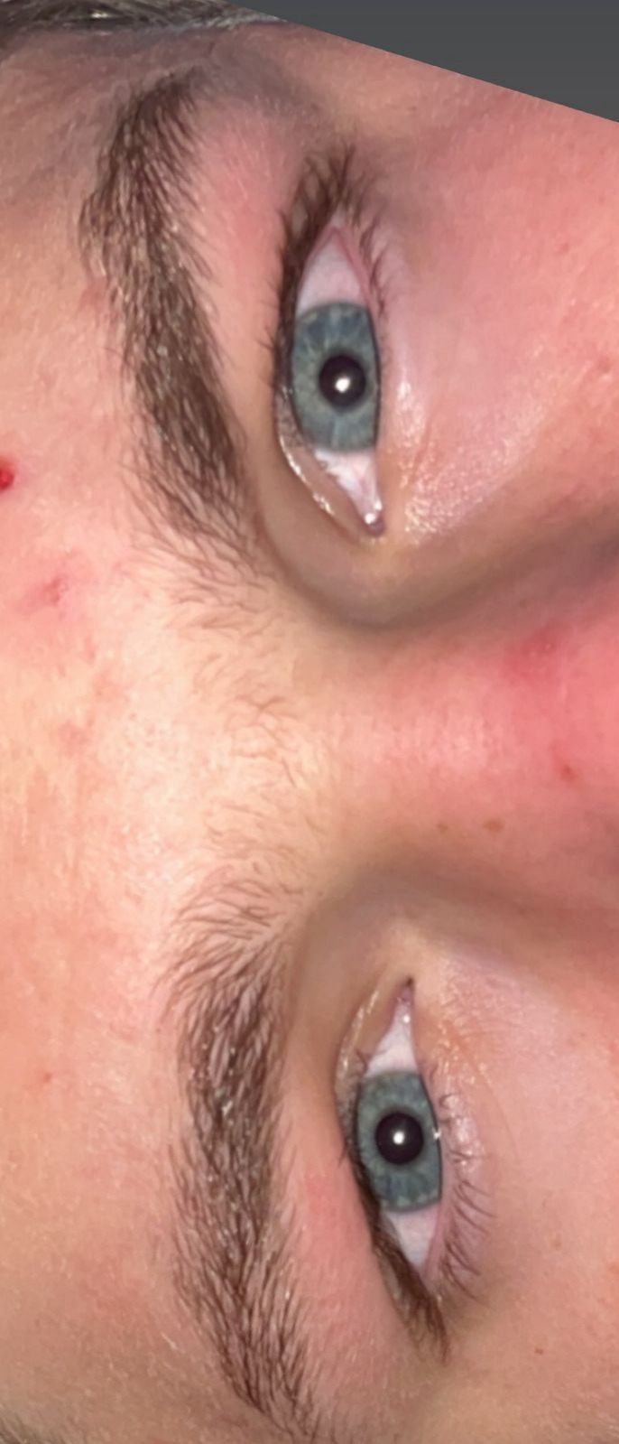 Eye1