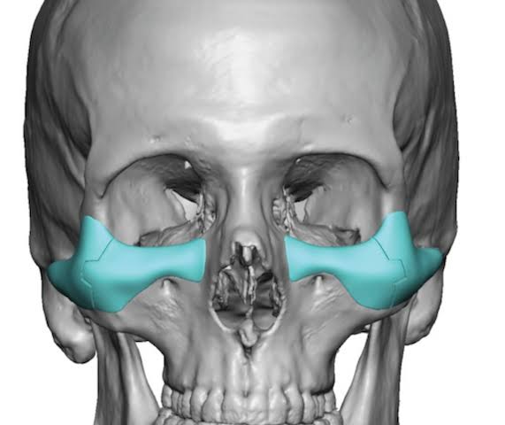 1000025589 1000025589