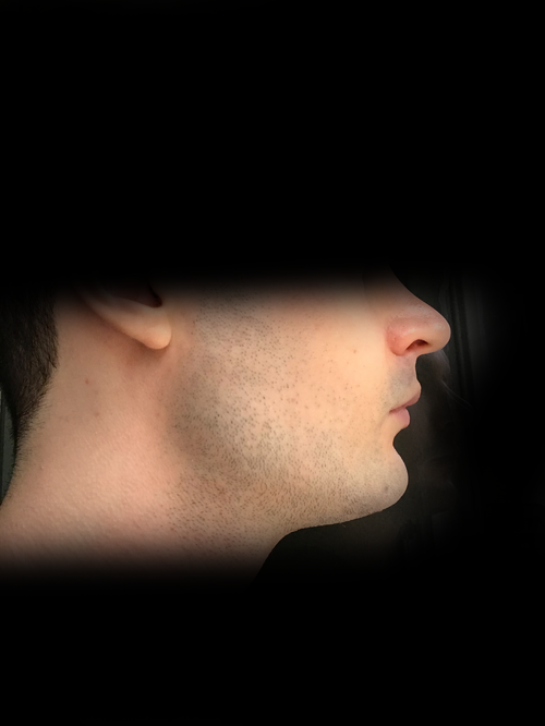 side.png
