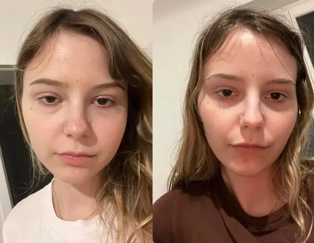 day-42-of-mse-face-changes-v0-8tr9owe6mubf1.jpg.webp