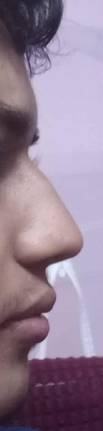 62d6c6a4-4d6d-4b1d-a3d4-37db4dd1b4fa.jpg