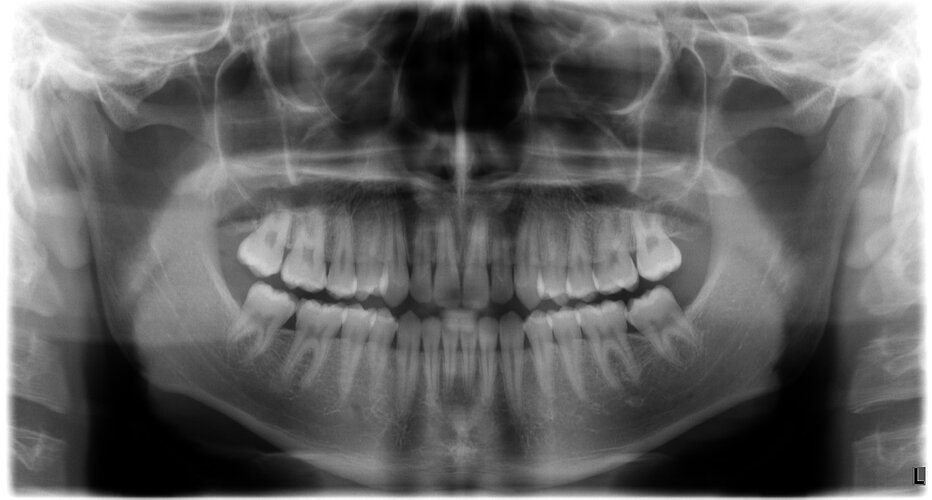 bid xray.jpg