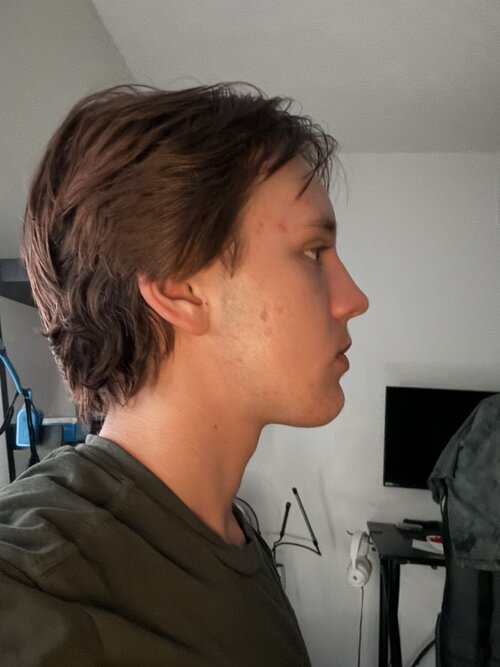 IMG 0603