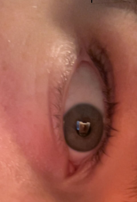 my eye.png