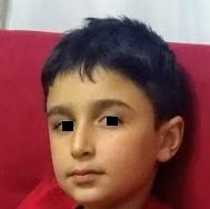 4966111 adenoidsonraside2 4966111 adenoidsonraside2