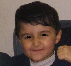 4966006 Before adenoid 4966006 Before adenoid