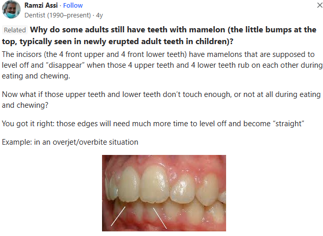 Ekran grnts 2025 09 20 165636 Ekran grnts 2025 09 20 165636