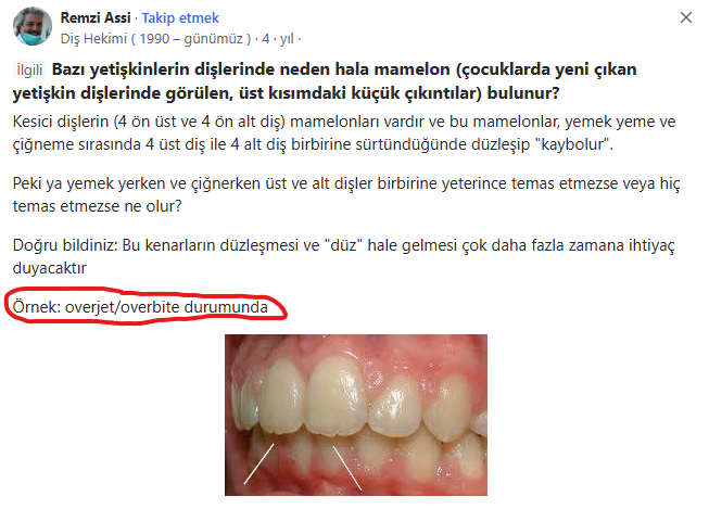 Ekran grnts 2025 09 20 165516 Ekran grnts 2025 09 20 165516