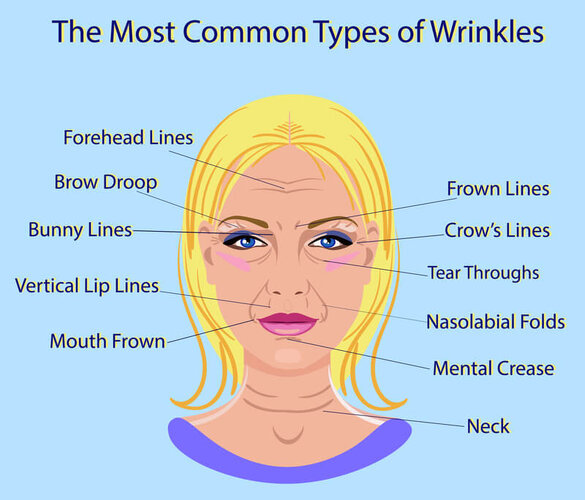 common-types-of-wrinkles.jpg