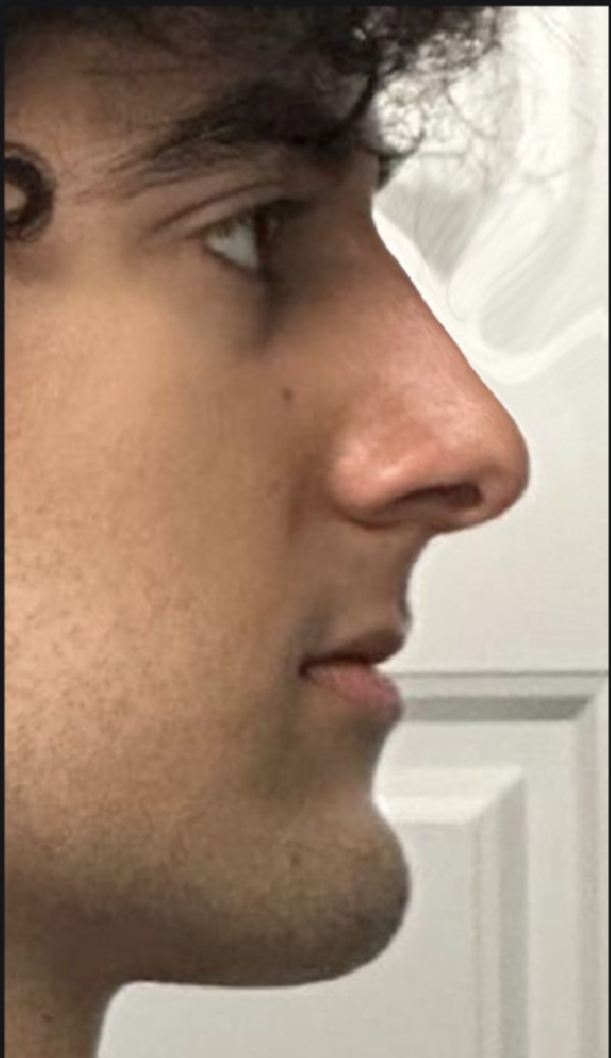 1000035487