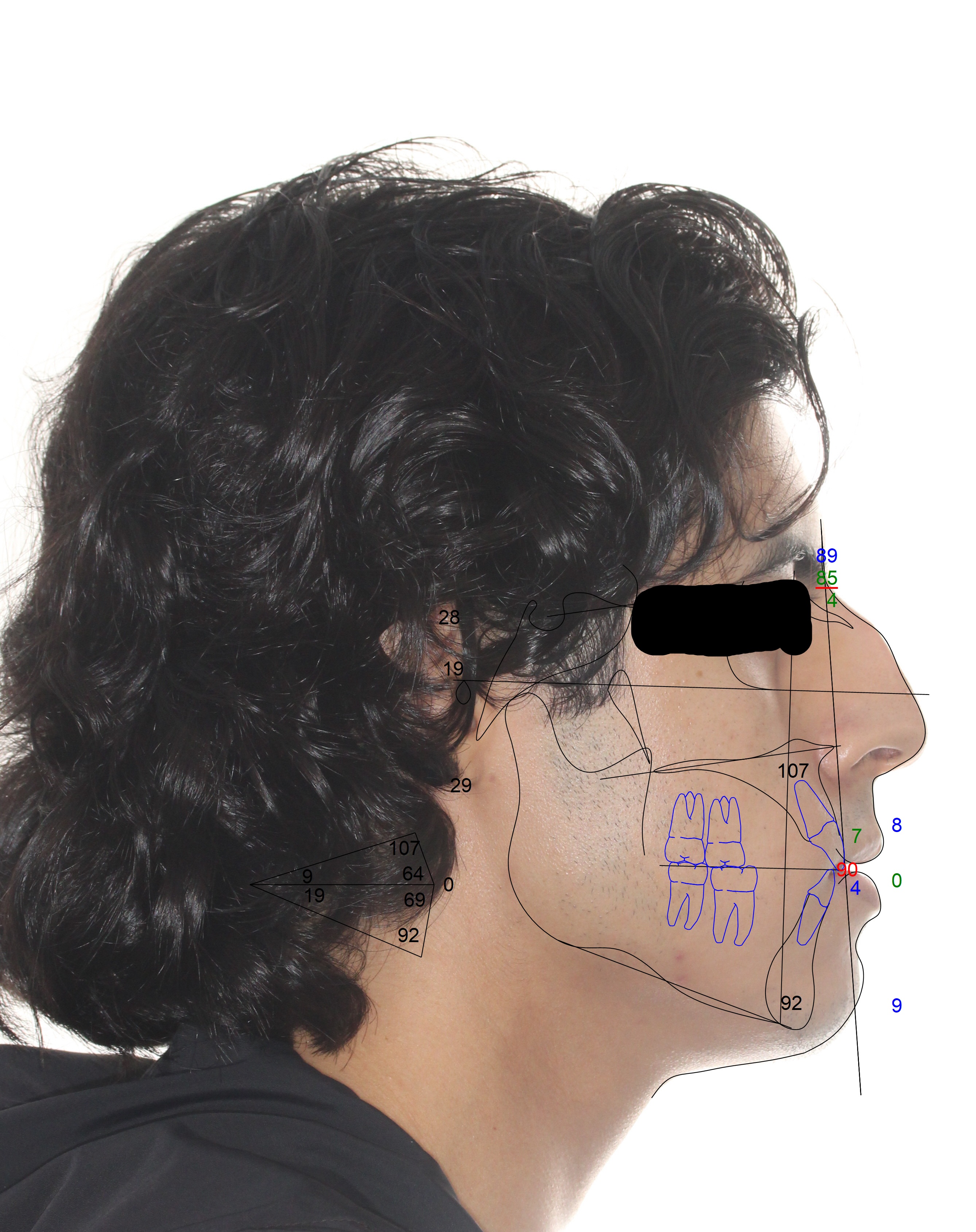 So Lateral Tracing Overlay