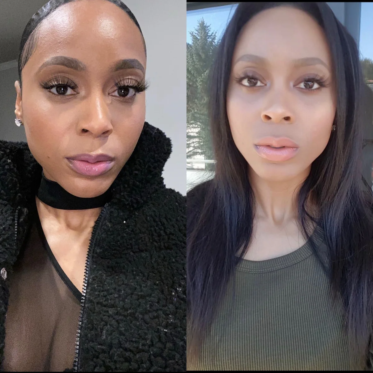 Hyperpigmentation before and after 1668717490048 1200x