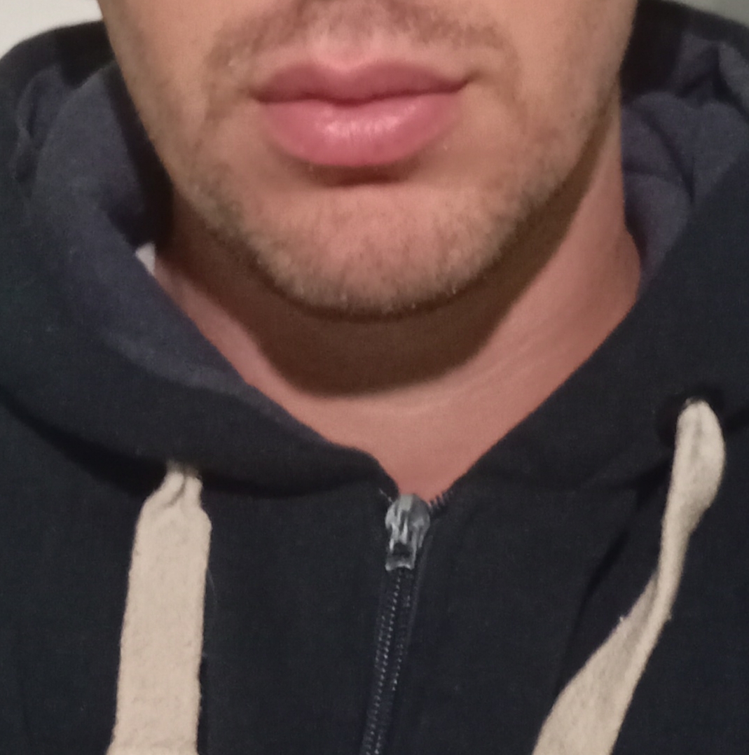 1000013859 1000013859