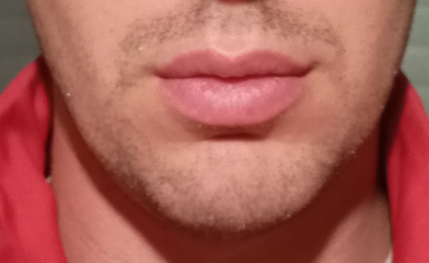 1000013860 1000013860