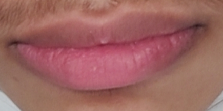 1000026179