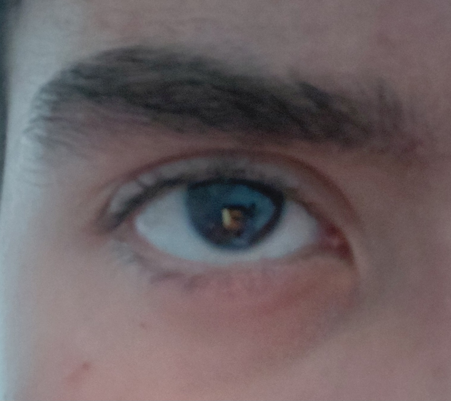 1000030849