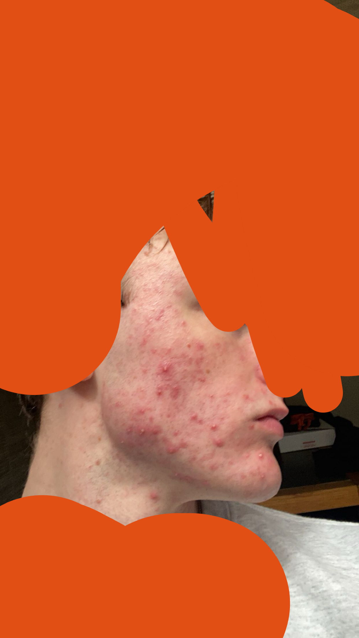 IMG 7237