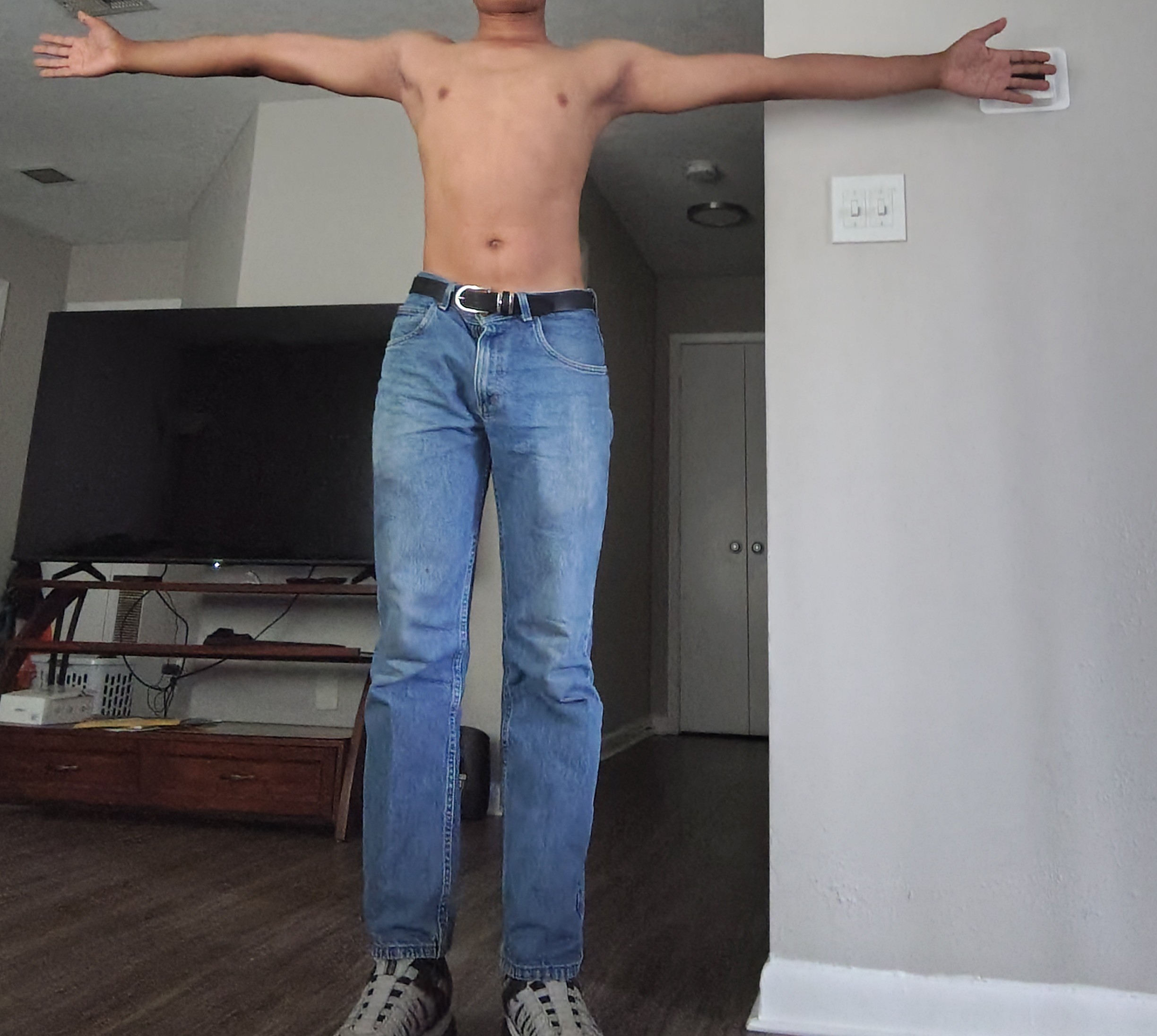 1000001551