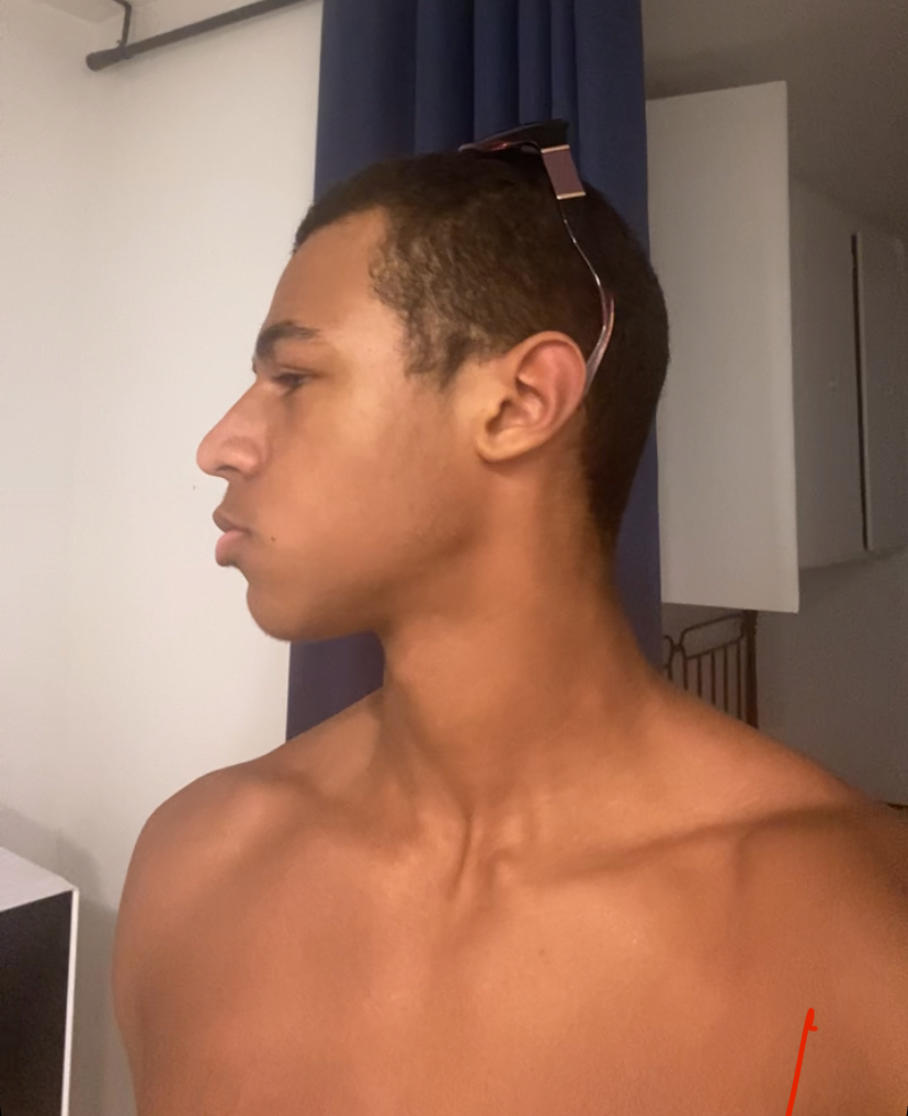 IMG 0202
