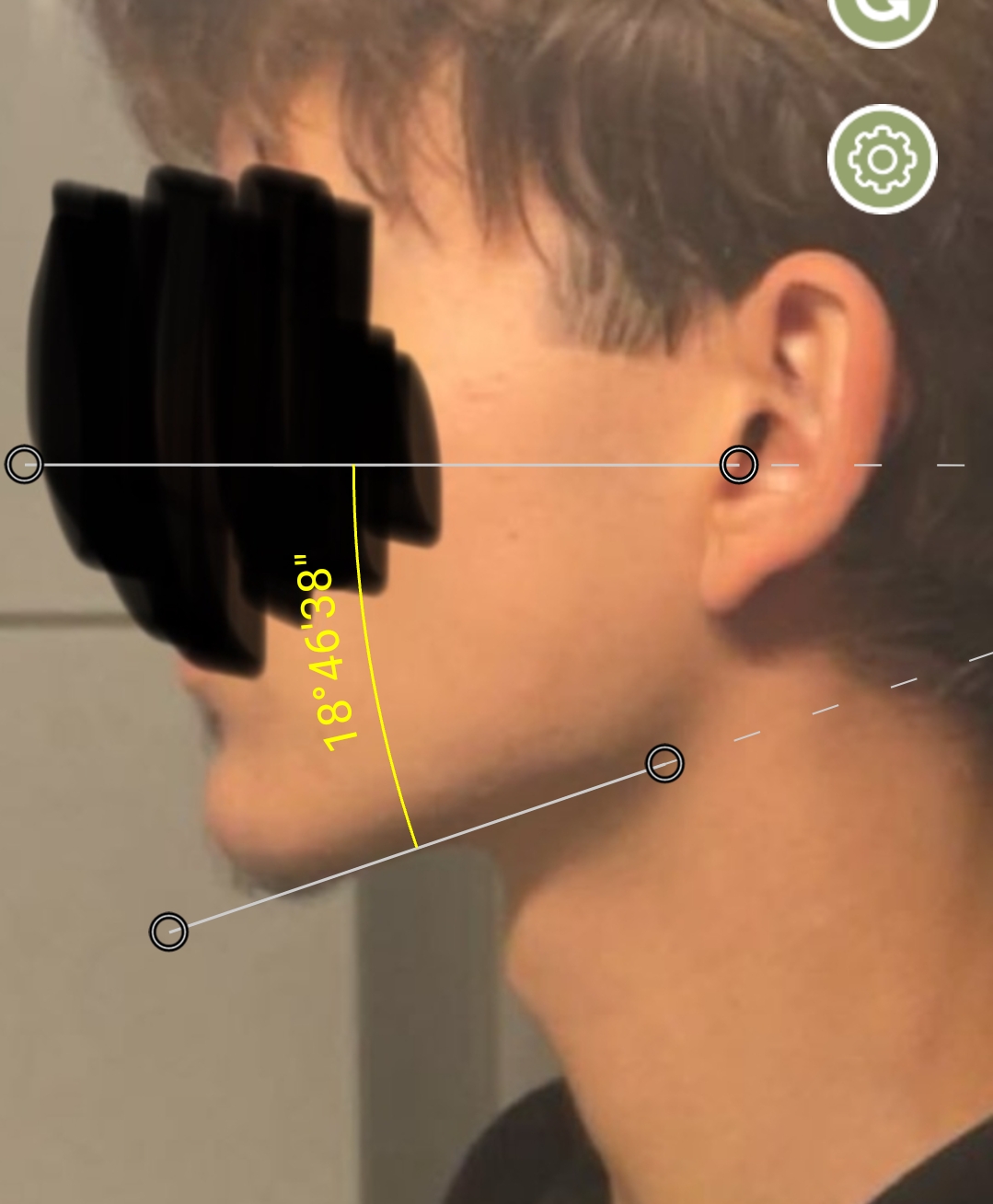 1000026399